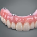 Combining Dentures with Other Dental Procedures: A Comprehensive Look