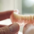 Average Cost of Different Types of Dentures