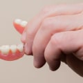 Benefits of Removable Bridges: A Guide to a Better Smile