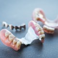 Improving the Fit and Function of Existing Partial Dentures: A Before-and-After Case Study