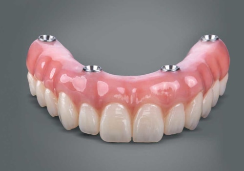 Combining Dentures with Other Dental Procedures: A Comprehensive Look