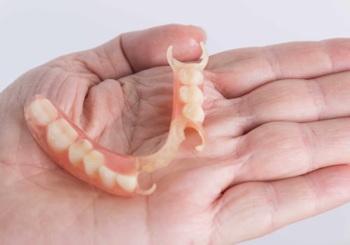 A Comprehensive Look at Flexible Partial Dentures