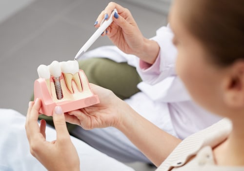 Maximizing Insurance Coverage for Dentures: A Comprehensive Guide