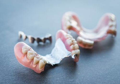 Improving the Fit and Function of Existing Partial Dentures: A Before-and-After Case Study