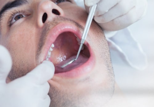 Understanding Bar-Retained Dentures: A Comprehensive Look