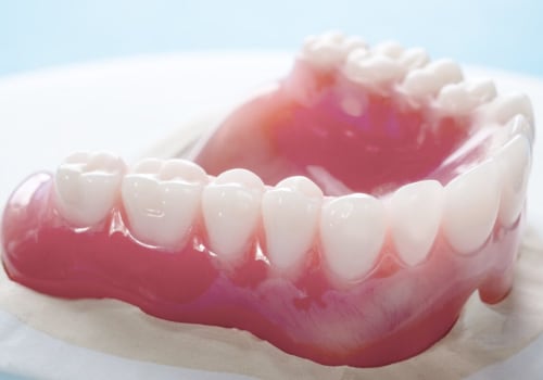 All You Need to Know About Traditional Full Dentures